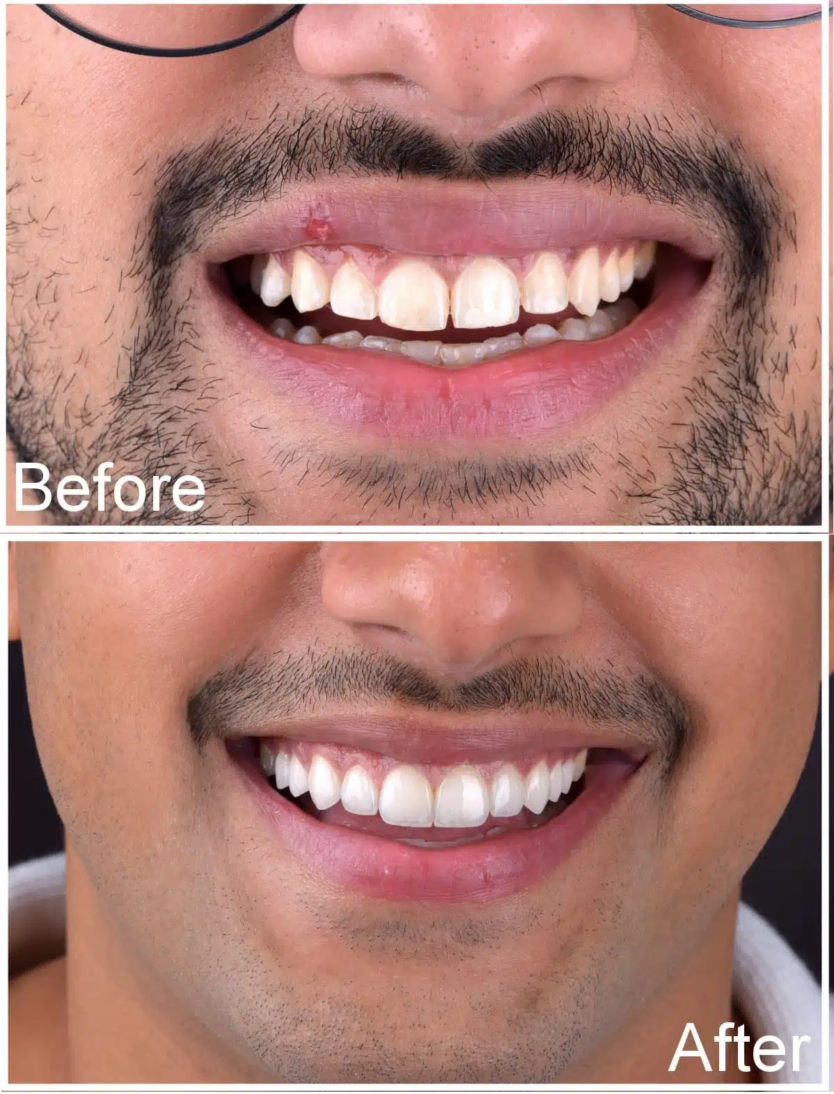 Almuhanna Case 4