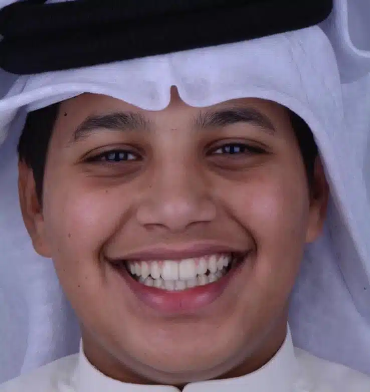 د. يوسف المفرج 3 almufarej_case1a
