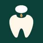 Dental fillings
