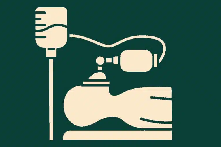 Treatment under General Anesthesia