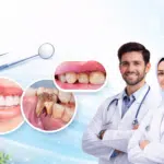 hidden dental issues